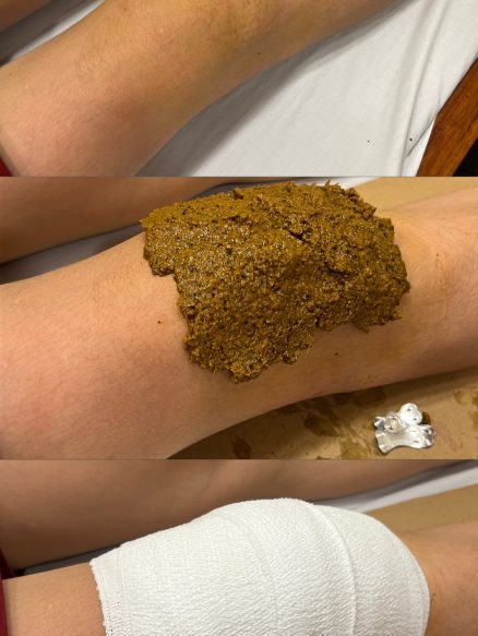 95E2641E-0A44-4D10-824D-011B22BBA3D8